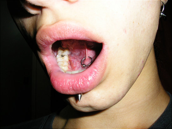 piercing lingua. piercings lingua. piercing na lingua, piercing; piercing na lingua, piercing